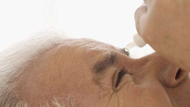 Home Treatment for Welding Flash Burn Eyes