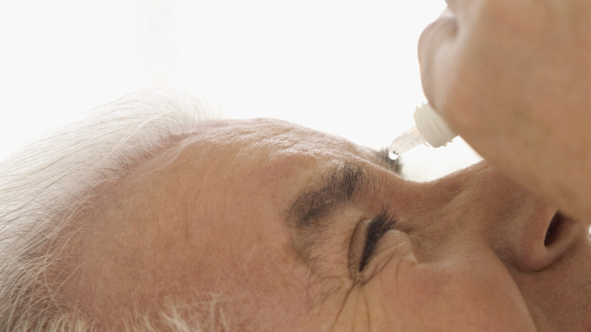 Home Treatment for Welding Flash Burn Eyes